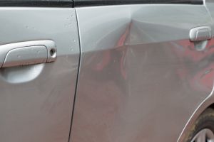 Dent Removal